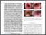 [thumbnail of Zolgharni_etal_JBHI_2020_Learning_spatiotemporal_features_for_esophageal_abnormality_detection_from_endoscopic_videos_accepted_version.pdf]